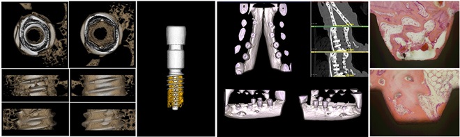 케이메디허브, 치과용 의료기기 독보적 기술 체계 구축